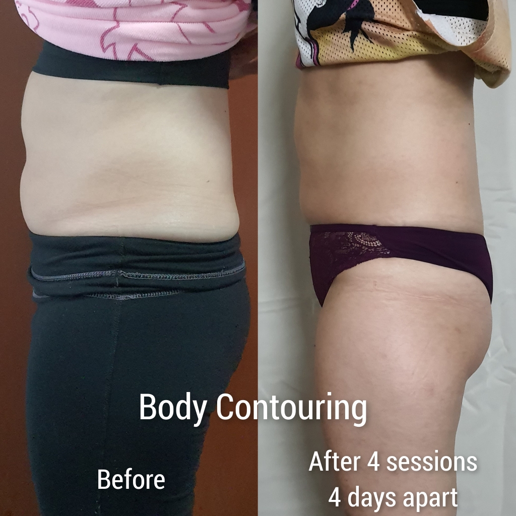 Body Contouring – Skin and Permanent Makeup Specialists